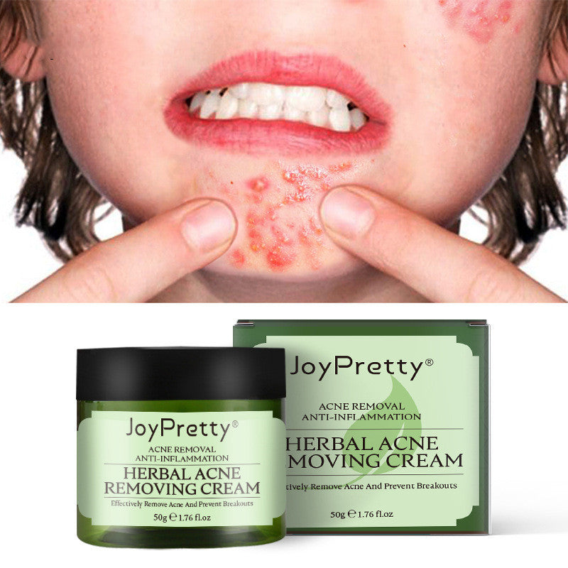 Herbal Acne Cream For Reducing Acne Marks Herbal Acne Cream For Reducing Acne Marks